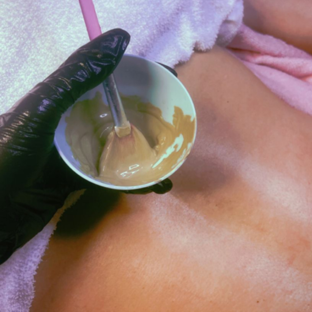 Back Facial with Microdermabrasion