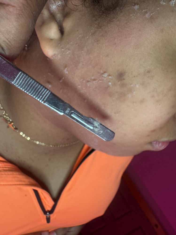 LA Rx Corrective Follow-Up Facial