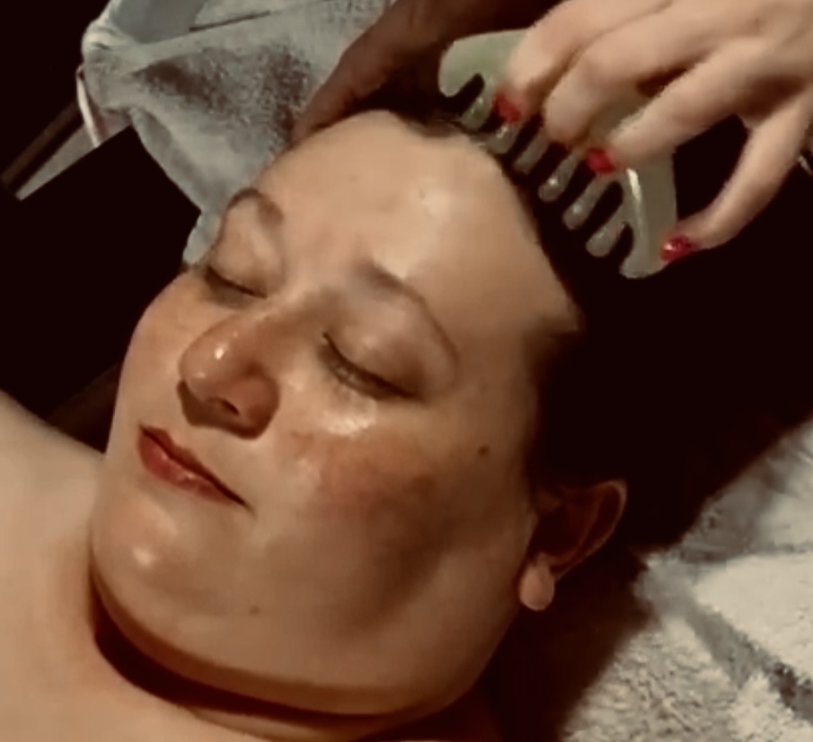 Hydrodermabrasion Treatment