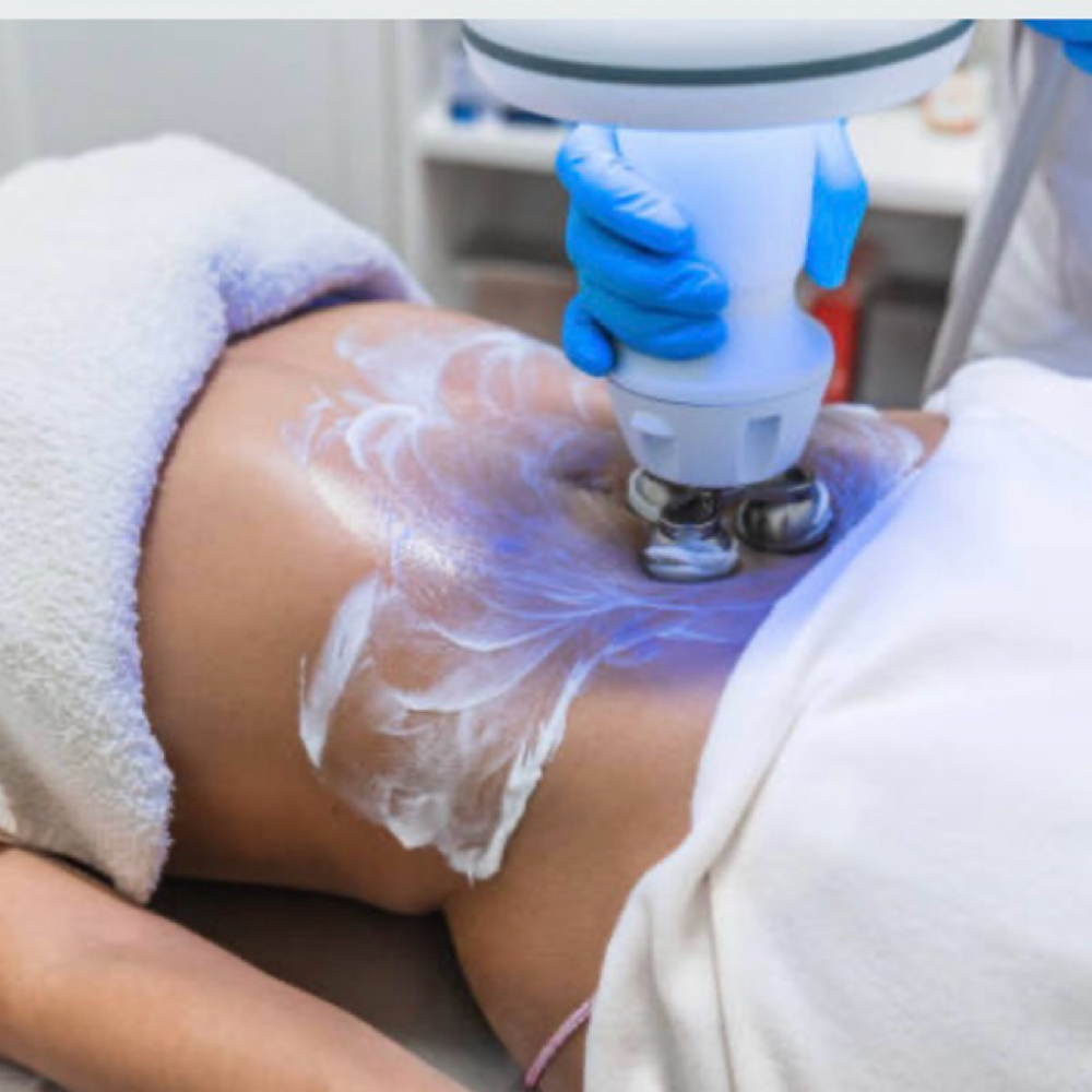 HG BODY SCULPT | 1 SESSION at Hourglass Body Aesthetics in Green Bay, WI