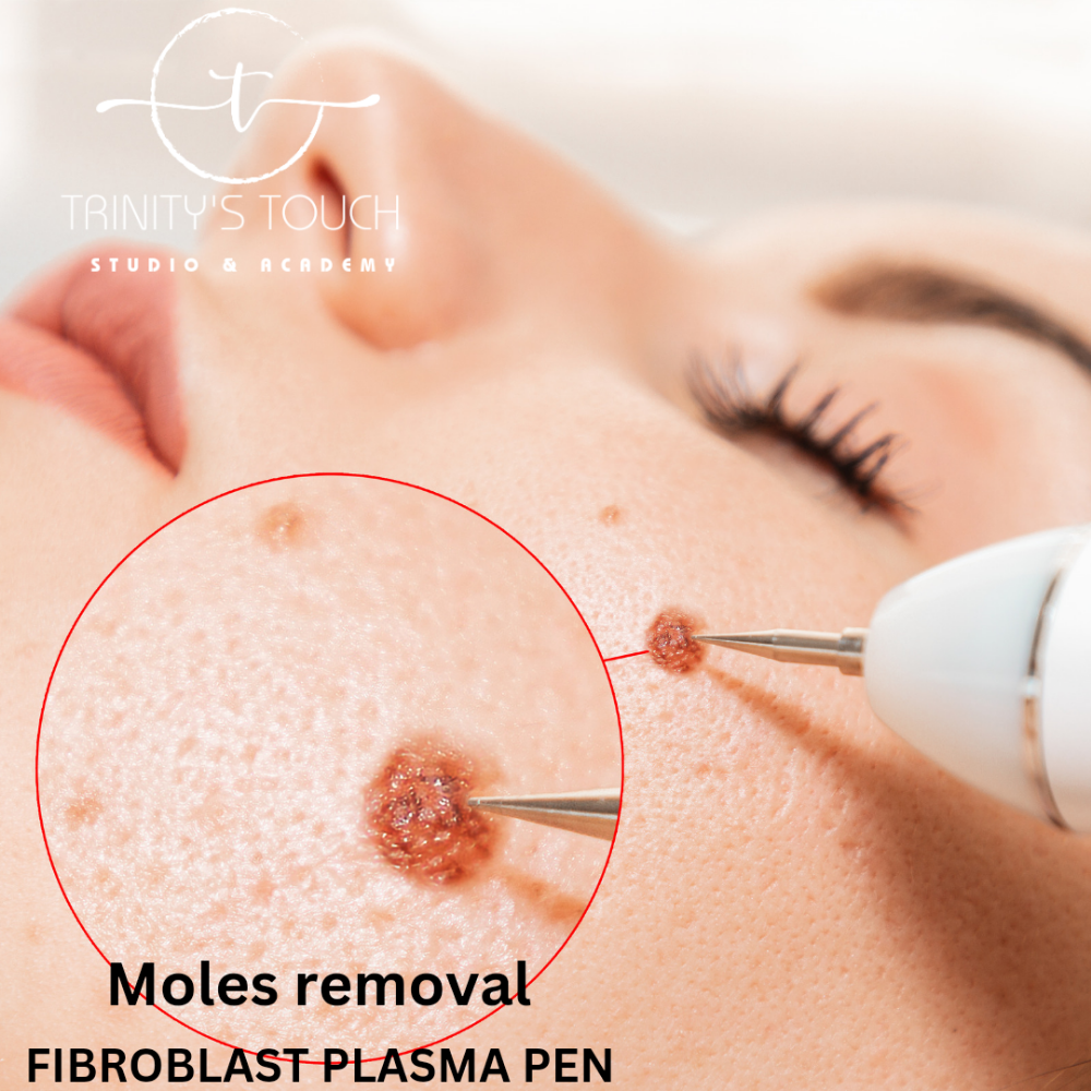 MOLES REMOVAL