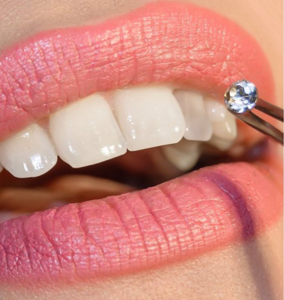 Swarovski Tooth Gem