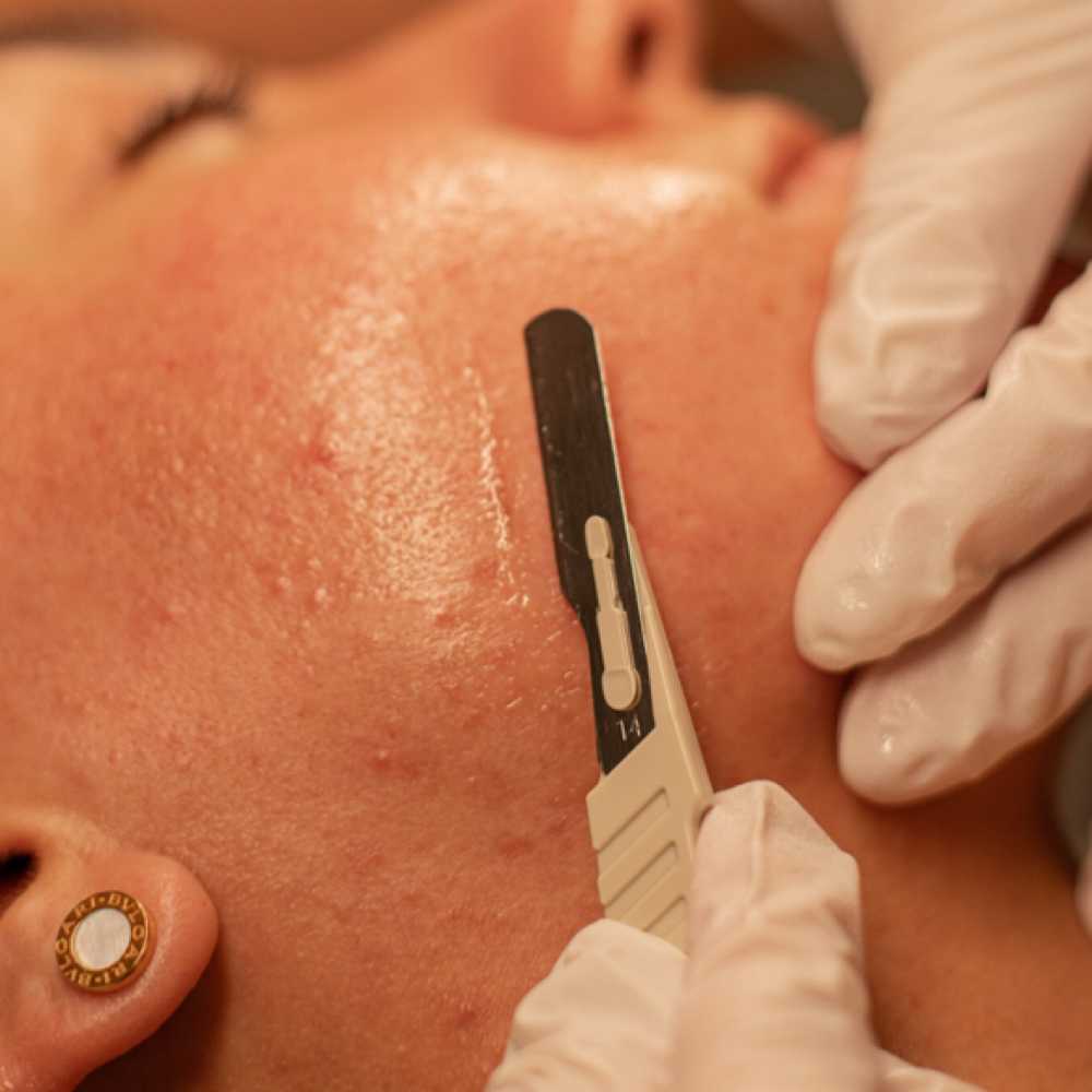 Derma-Express at MySkin Aesthetics in Laredo, TX