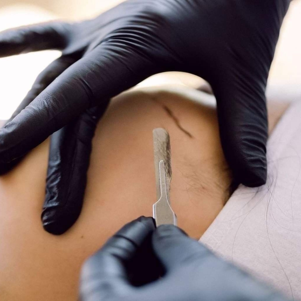 The Dermaplane Facial at Bk Esthetics LLC in Santee, SC