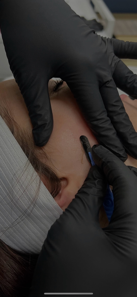 Dermaplane Facial