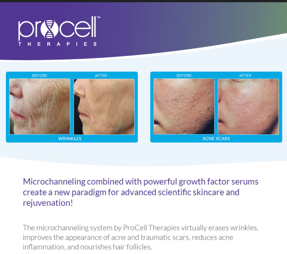 *PROMO* Procell & A Facial