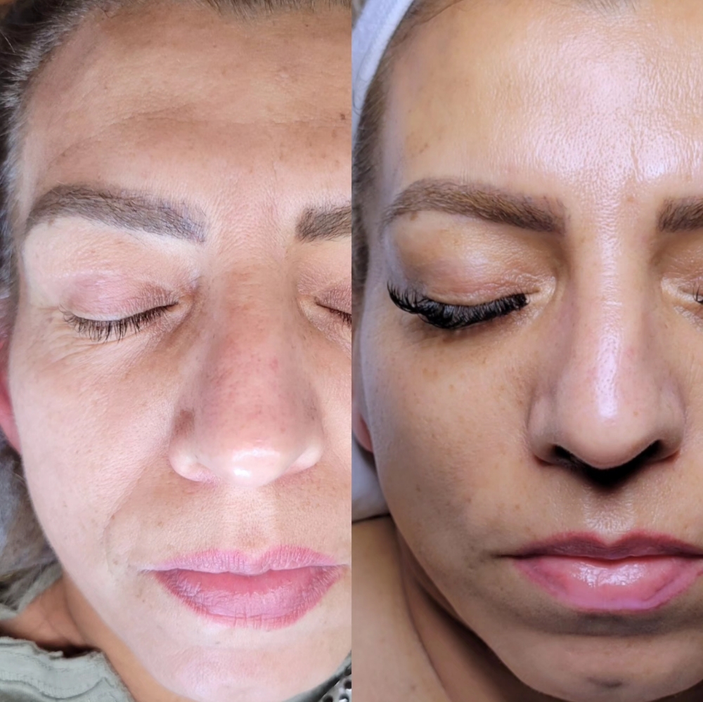 Morphe Custom Facial