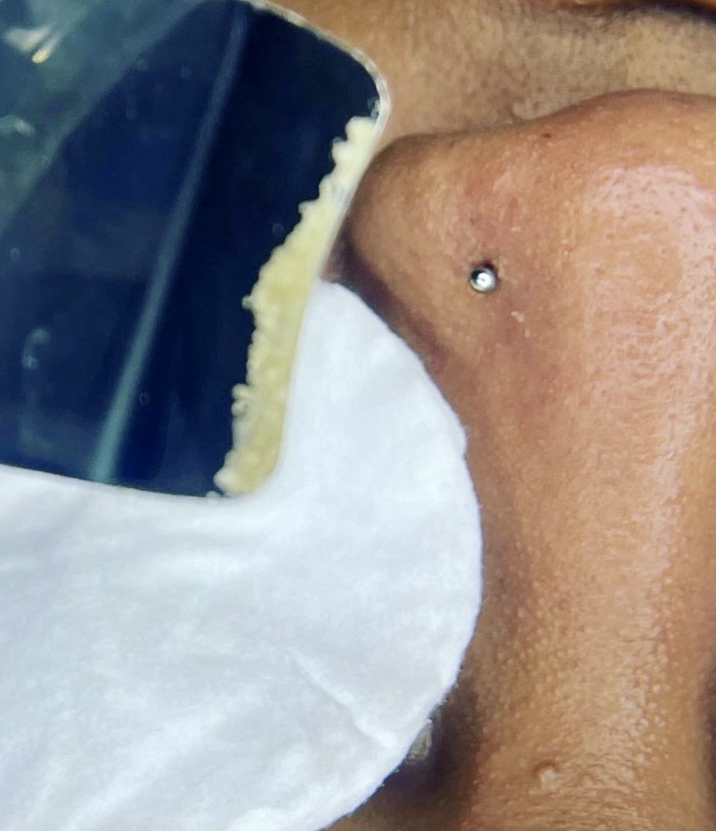 The Teen Glow Facial