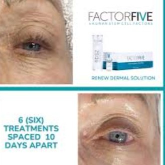 FACTOR 5 RDS PEEL at Affinity & Glow Aesthetics in Royal Oak, MI