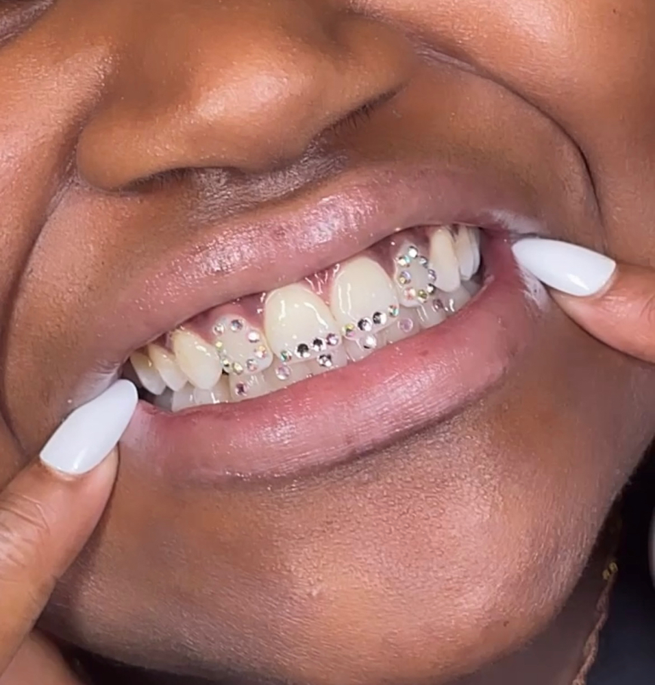Teeth Gems
