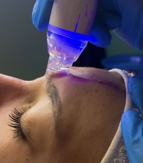 Hydra Extractions ADD-ON