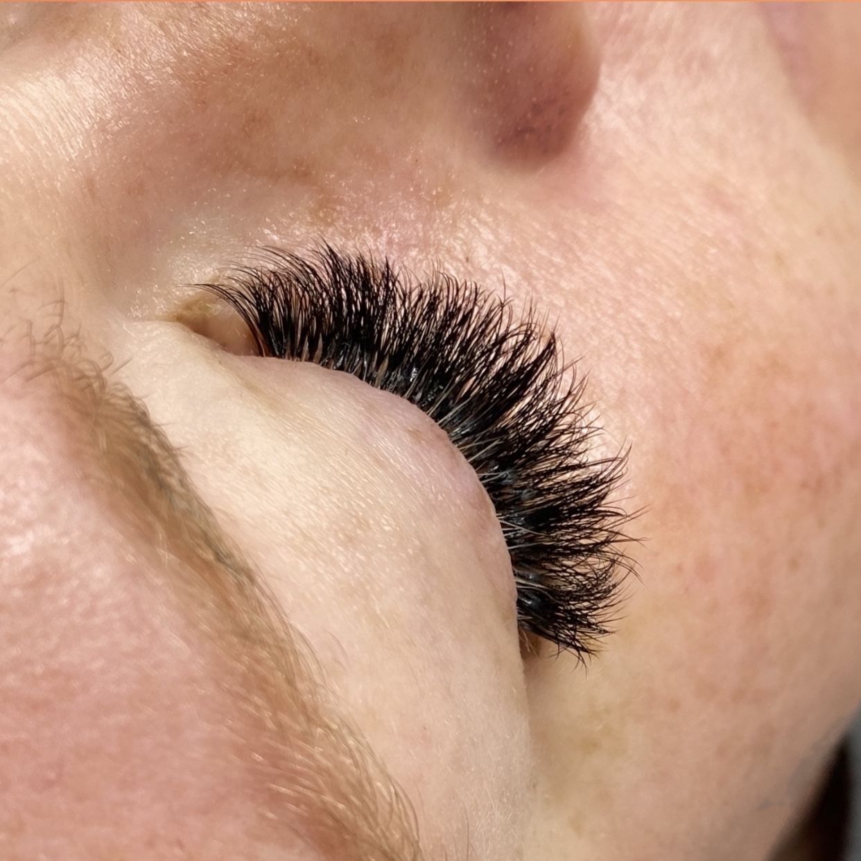 Mega Volume Fill