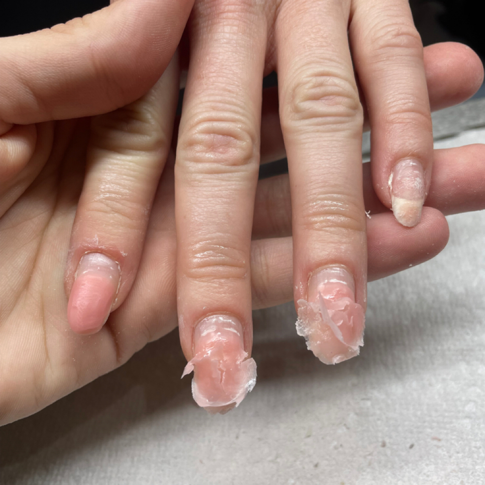 Removal at Cerise Noire in Cocoa, FL