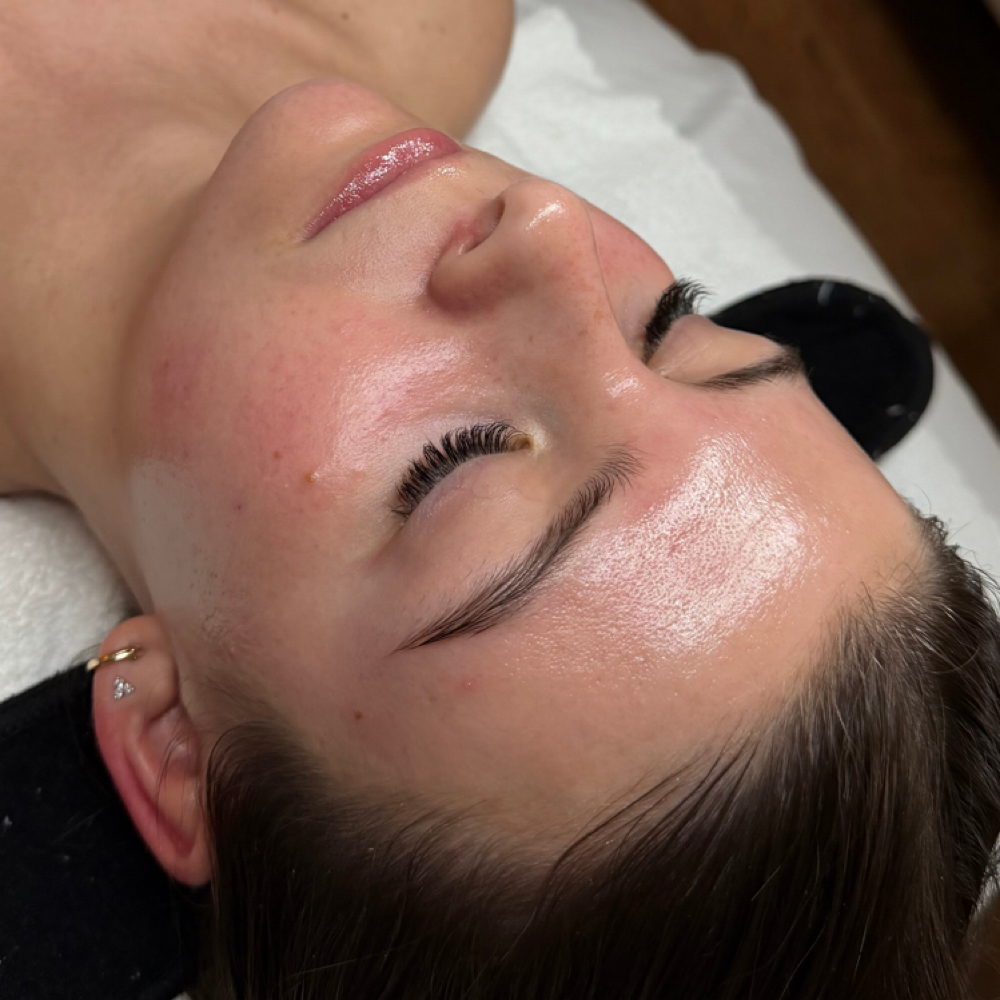 Dermaplane Facial