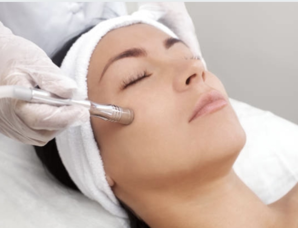 Diamond Microdermabrasion