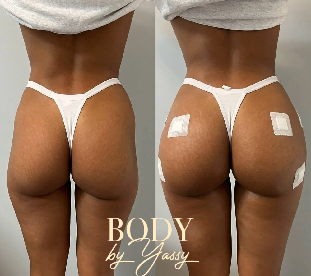 LIQUID BBL PACKAGE 300 ML