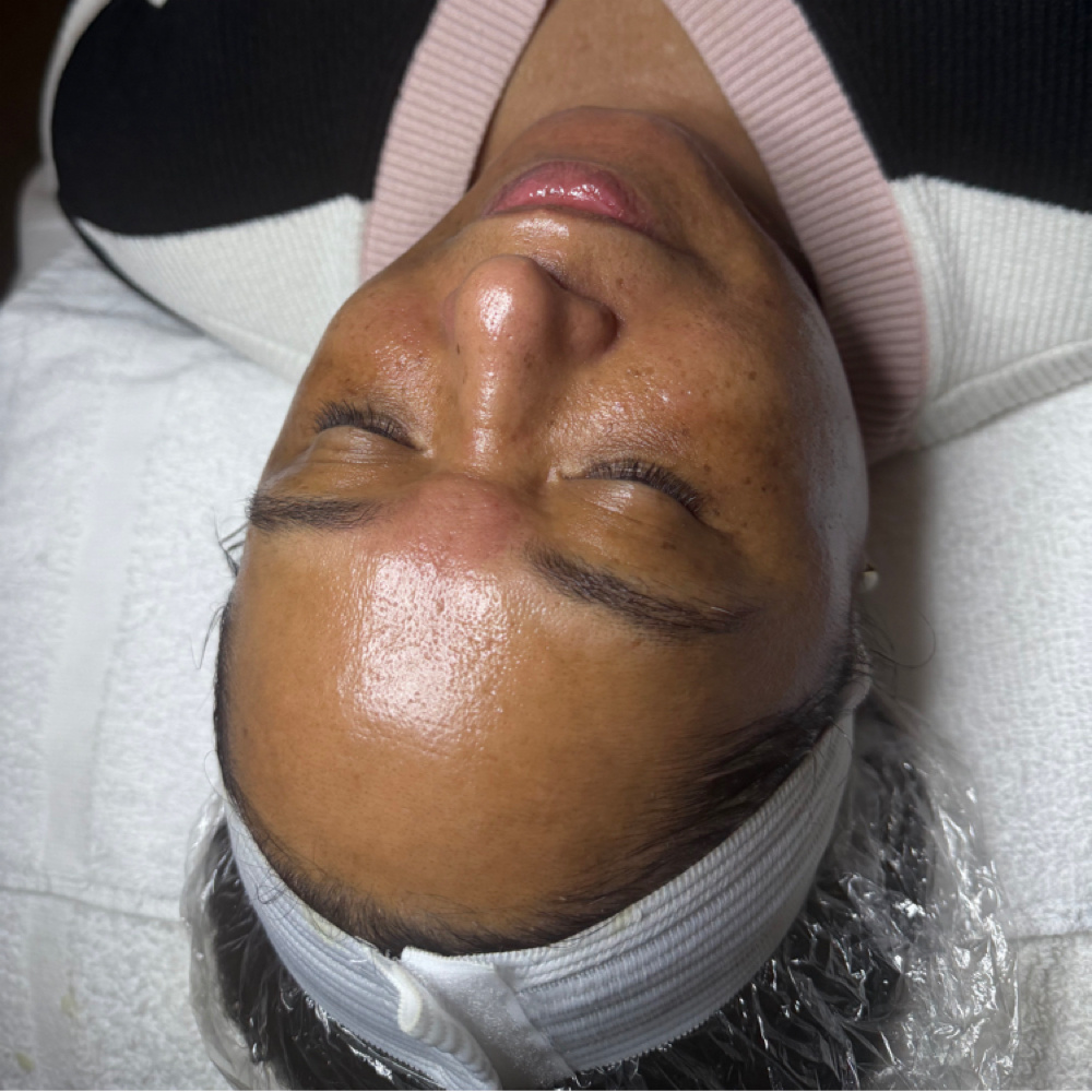 Glass Skin Facial with dermaplaning at Beauty By Jumilka in Perth Amboy, NJ
