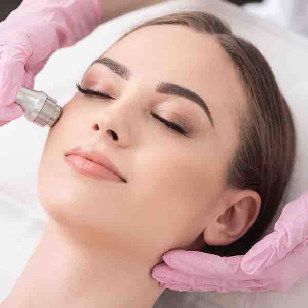 Microdermabrasion Treatment