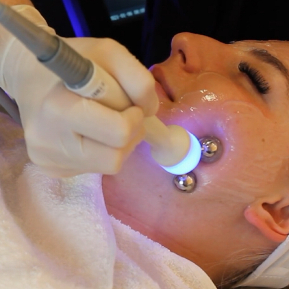 MediSpa Silver Facial Experience at Vibe Skin Lab in Woburn, MA