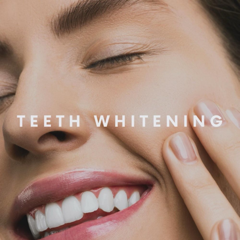 Teeth Whitening Double at The SunLab Tanning Co at Making Face Spa in Amherst, OH