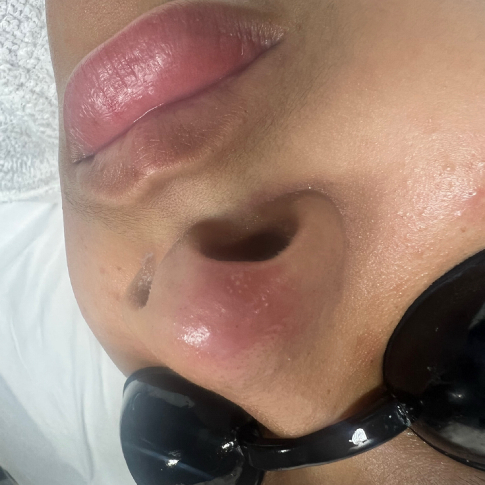 Circadia SWiCH at Elite Choice Skin in Baldwin, NY