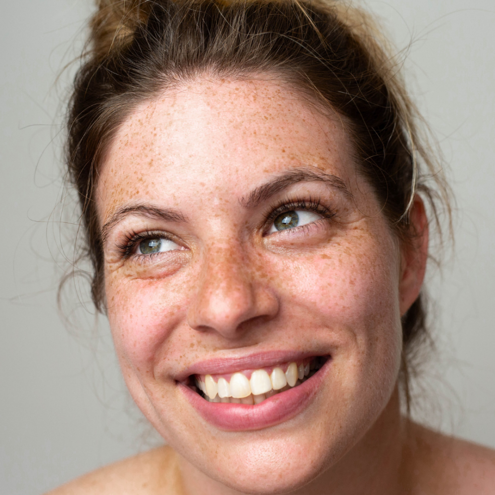 FAUX FRECKLES