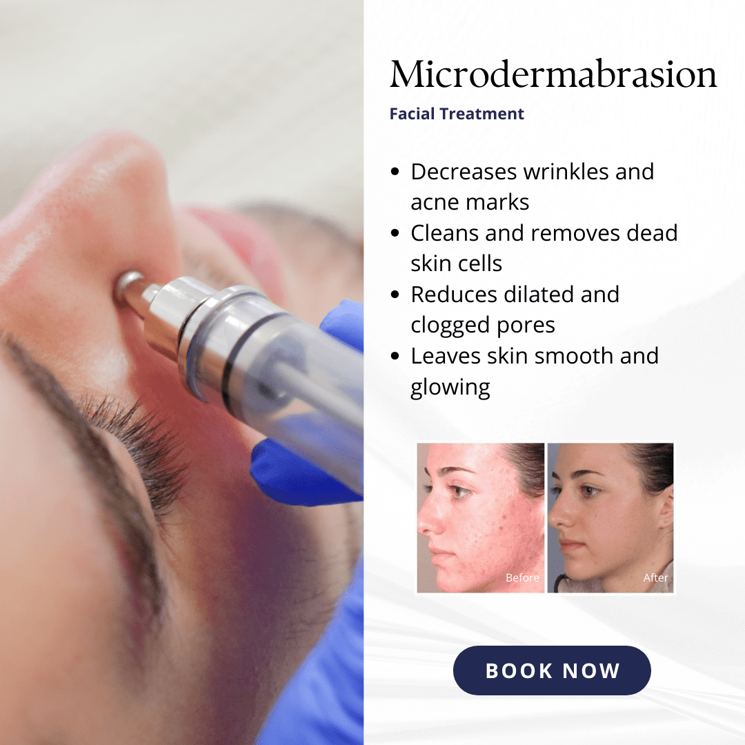 Microdermabrasion Facial