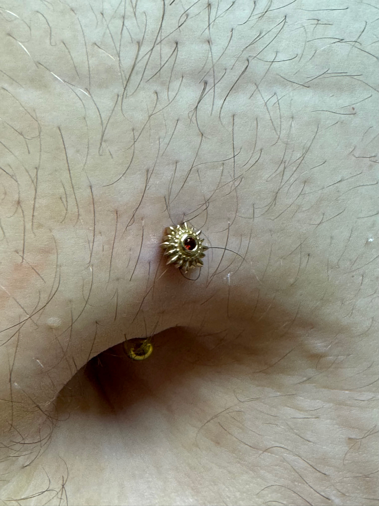 Navel (belly button)