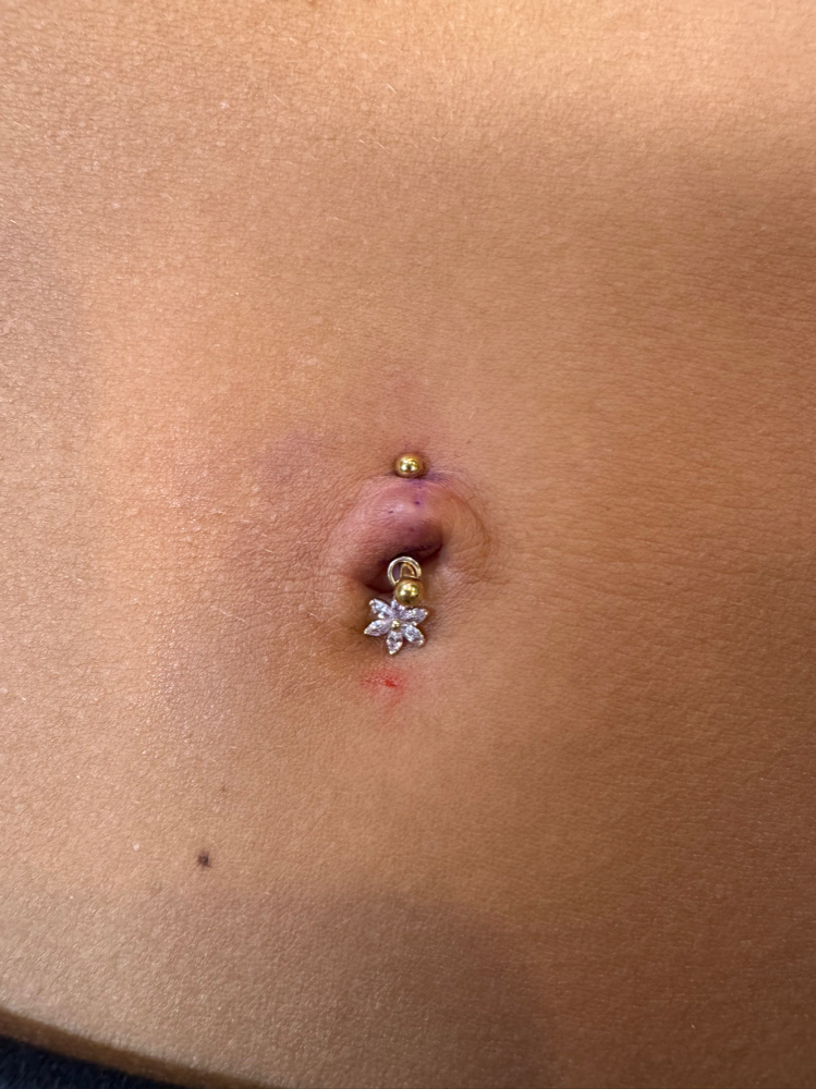 Navel (belly button)