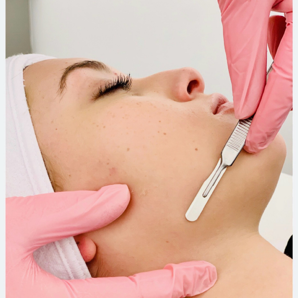 1 hr Dermaplane at Accentuated Beauty Spa in Salisbury, NC