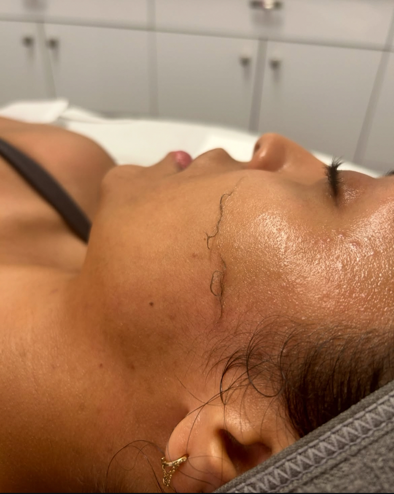 Dermaplane Certification Course