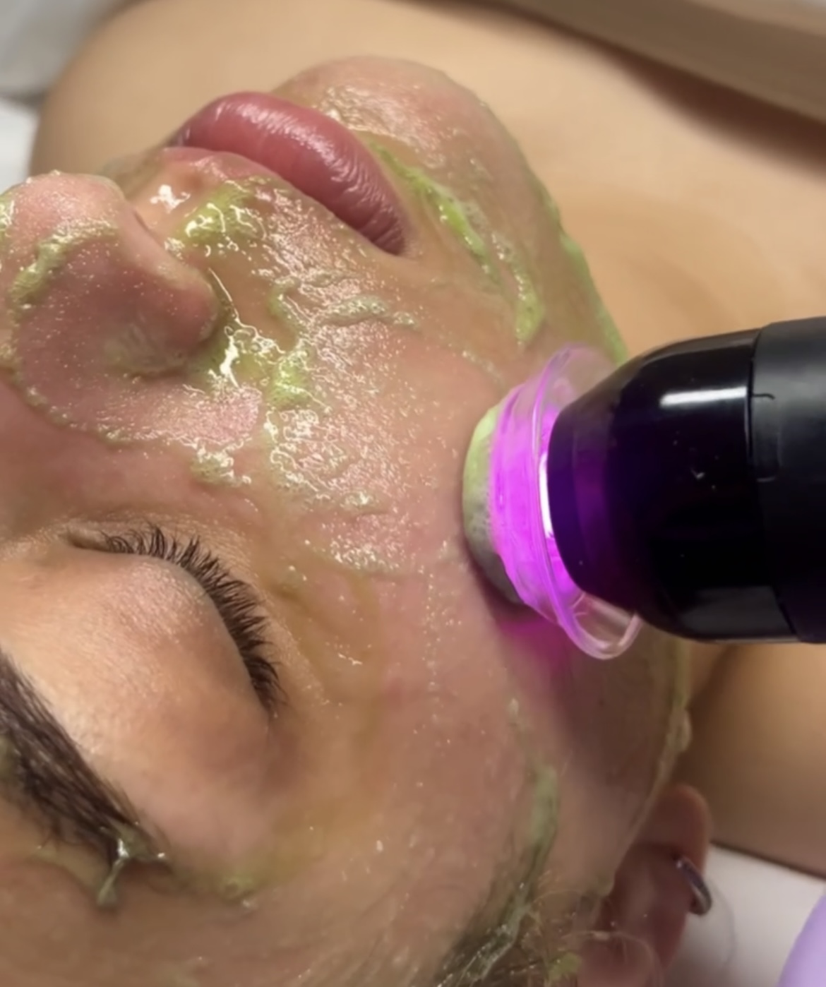 GlassSkin Glo2Facial– Detox/Hydrate