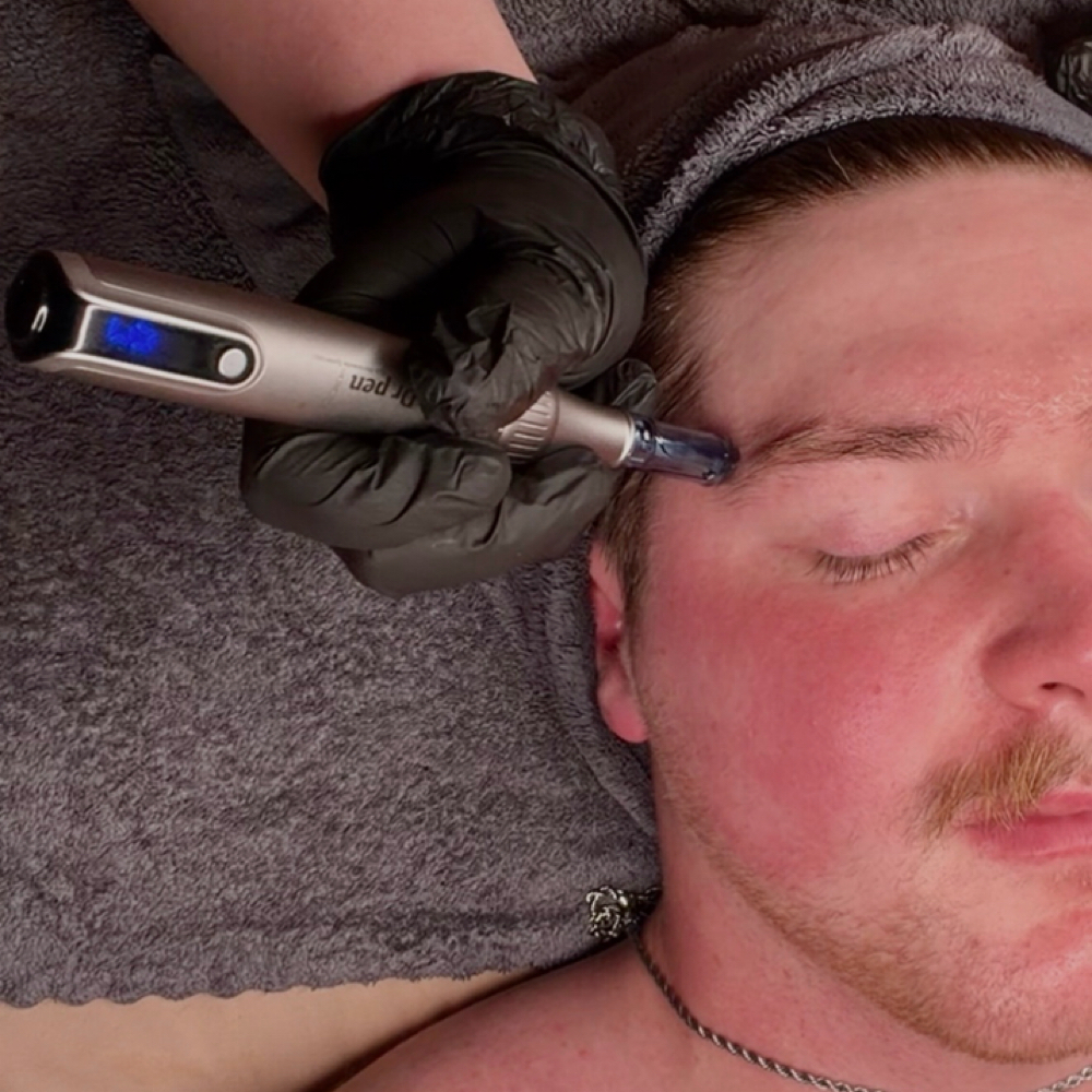 Add Nano-Glow Infusion! at Reese Artistry • Albany, OR Esthetician in Albany, OR