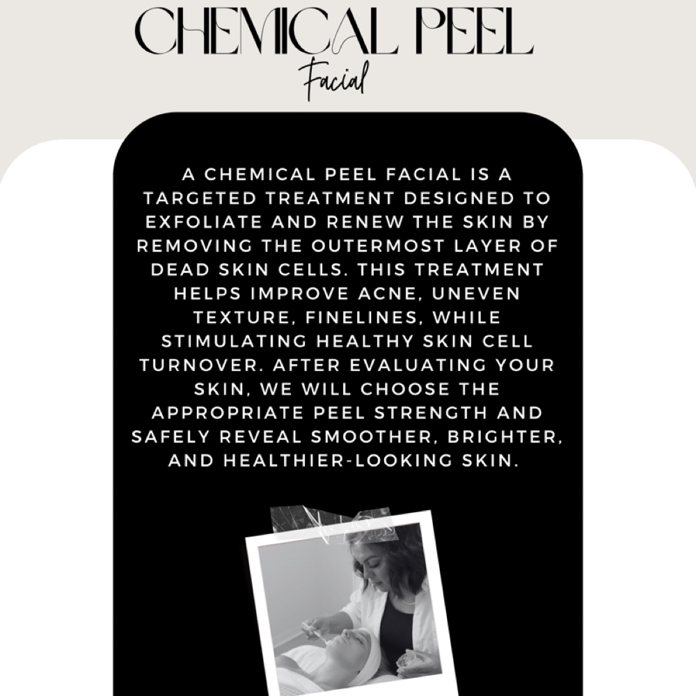 CHEMICAL PEEL FACIAL at Aesthetics By Abigail Hernandez in Mustang, OK