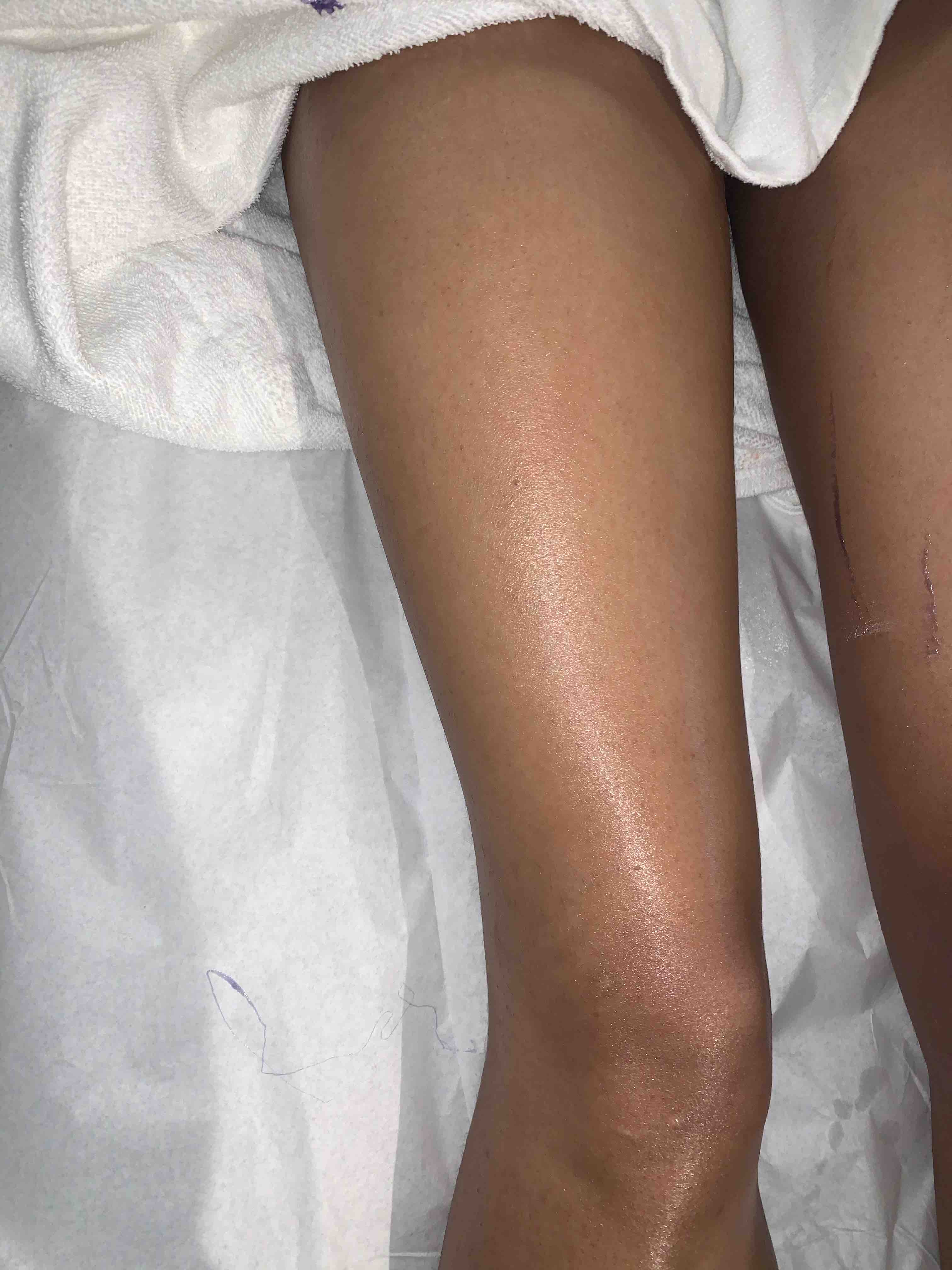 full leg
