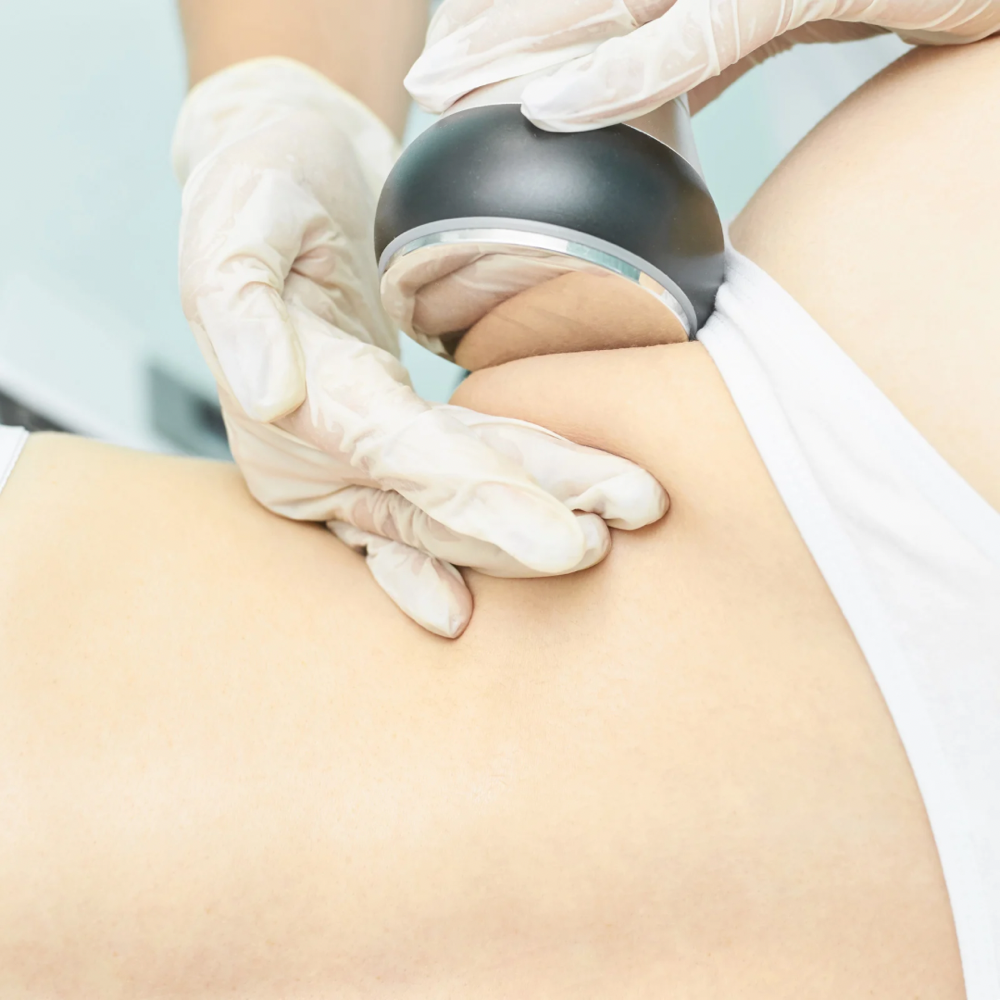 Body Contouring