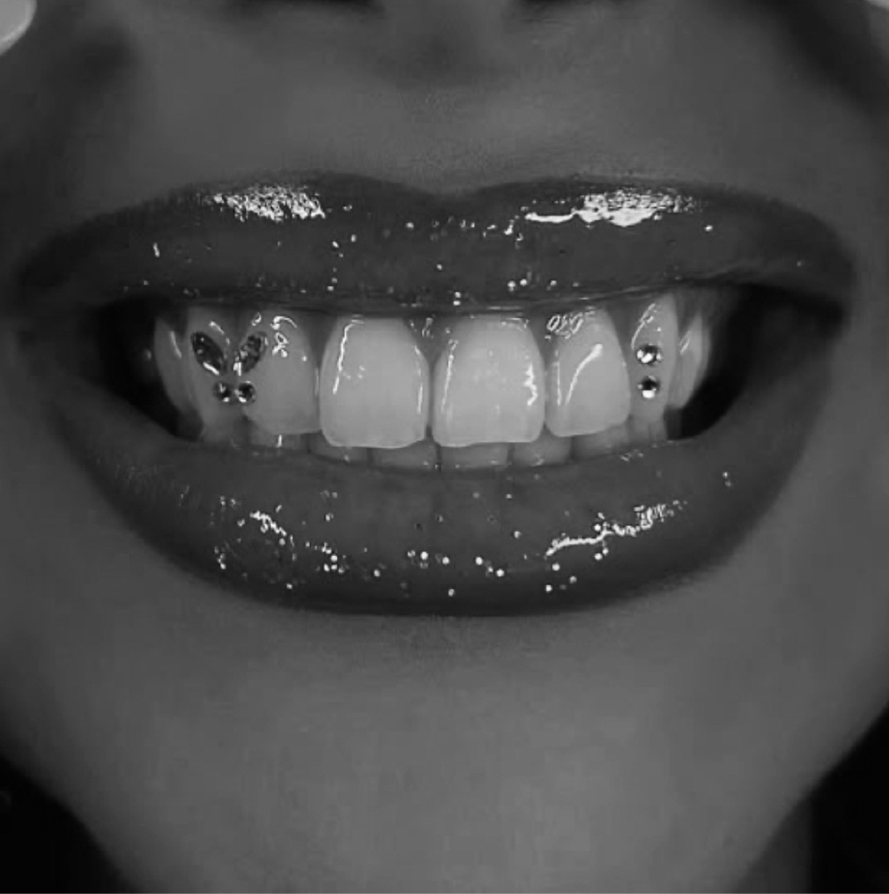 Tooth Gem - 1 at StarLuxeSpa in Sacramento, CA