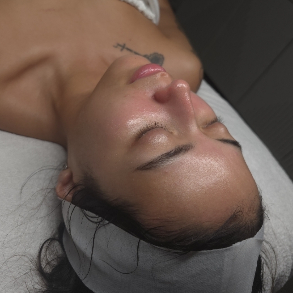 A1 Hydrodermabrasion Facial at Stephs A1 Beauty Bar in Southwest Ranches, FL