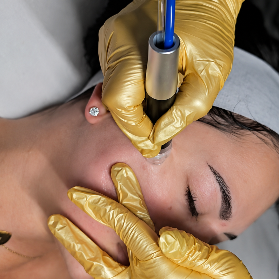 A1 HydroGlow Facial at Stephs A1 Beauty Bar in Southwest Ranches, FL