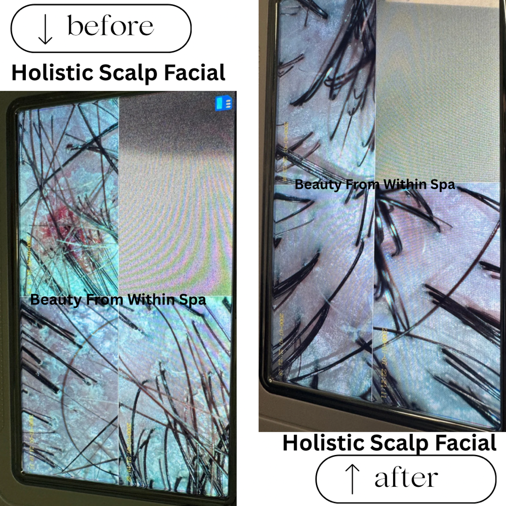 New ClientScalpDisorderScalp Facial