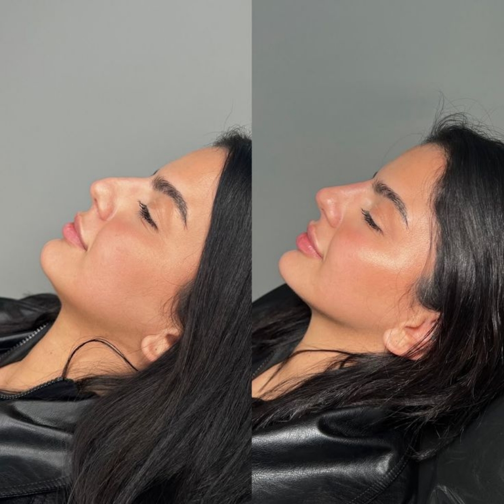 Signature Harmony Contour at D'Yalorde Wellness & Aesthetics LLC in El Paso, TX