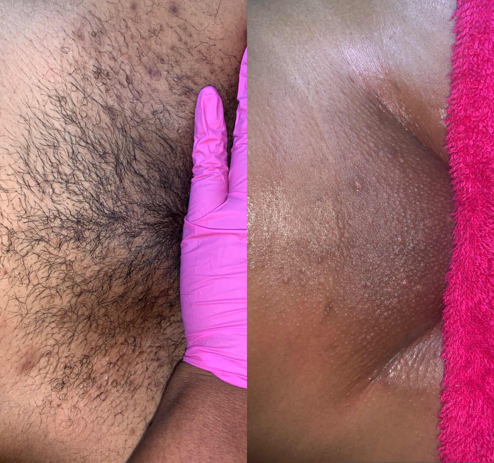 $35 Brazilian Thursday