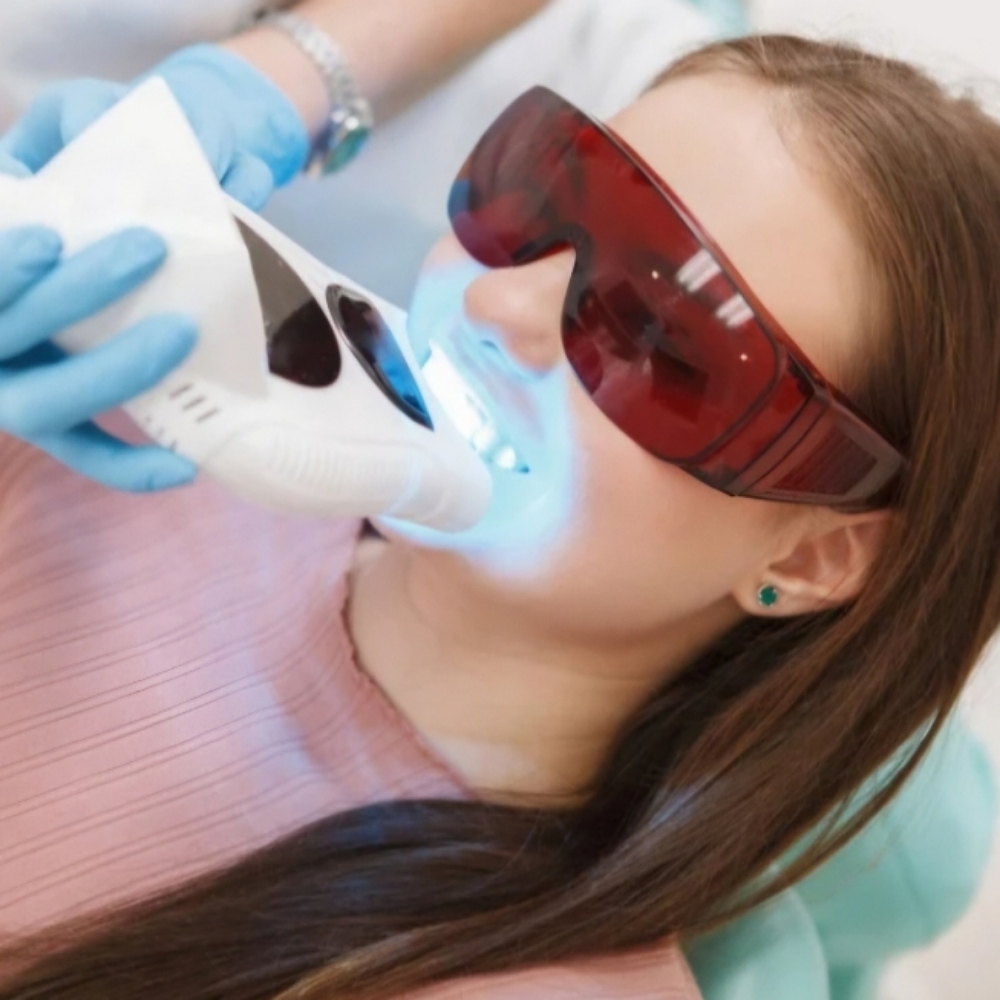 Teeth Whitening at Renue Spa And Wellness in Joliet, IL