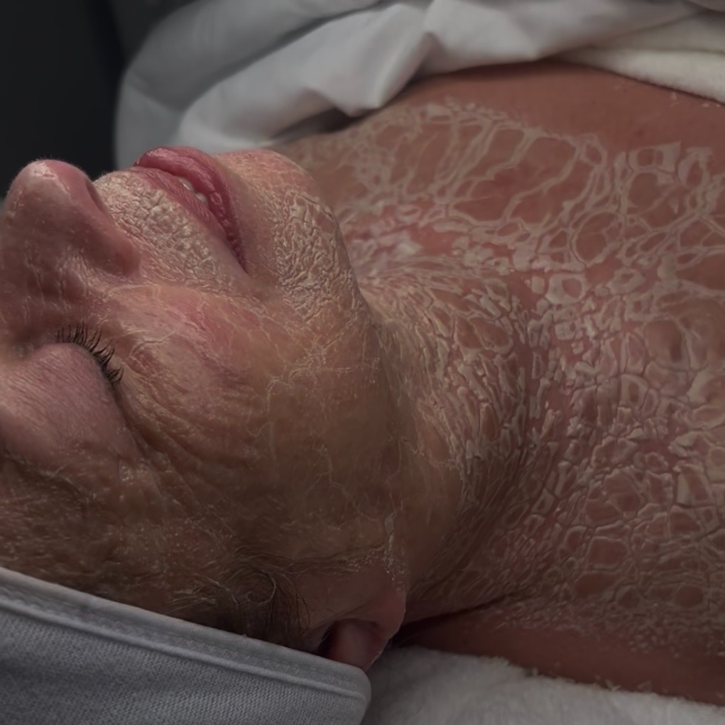 The Ageless Facial at Stone Skin Studio in Palm Harbor, FL
