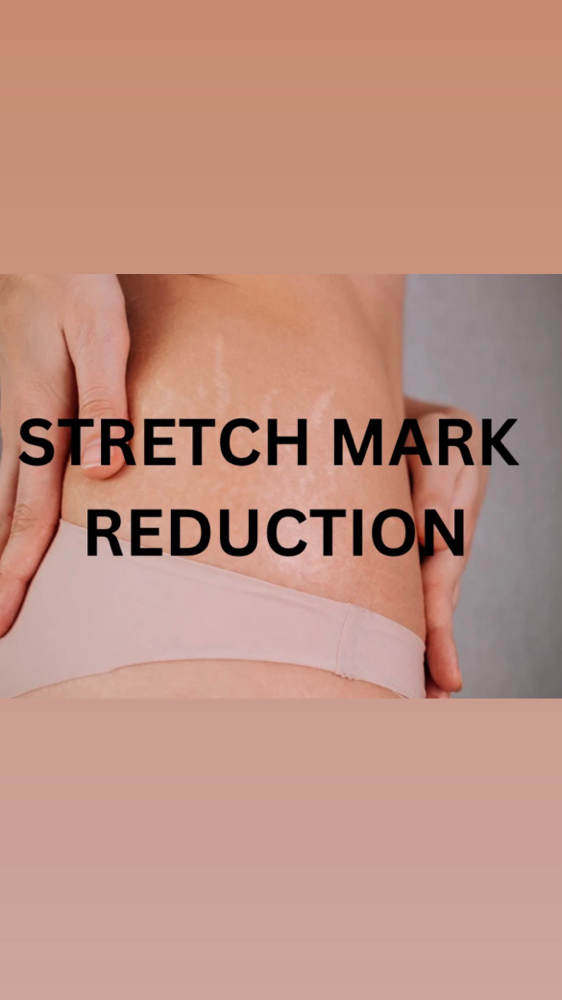 Stretch Mark Reduction