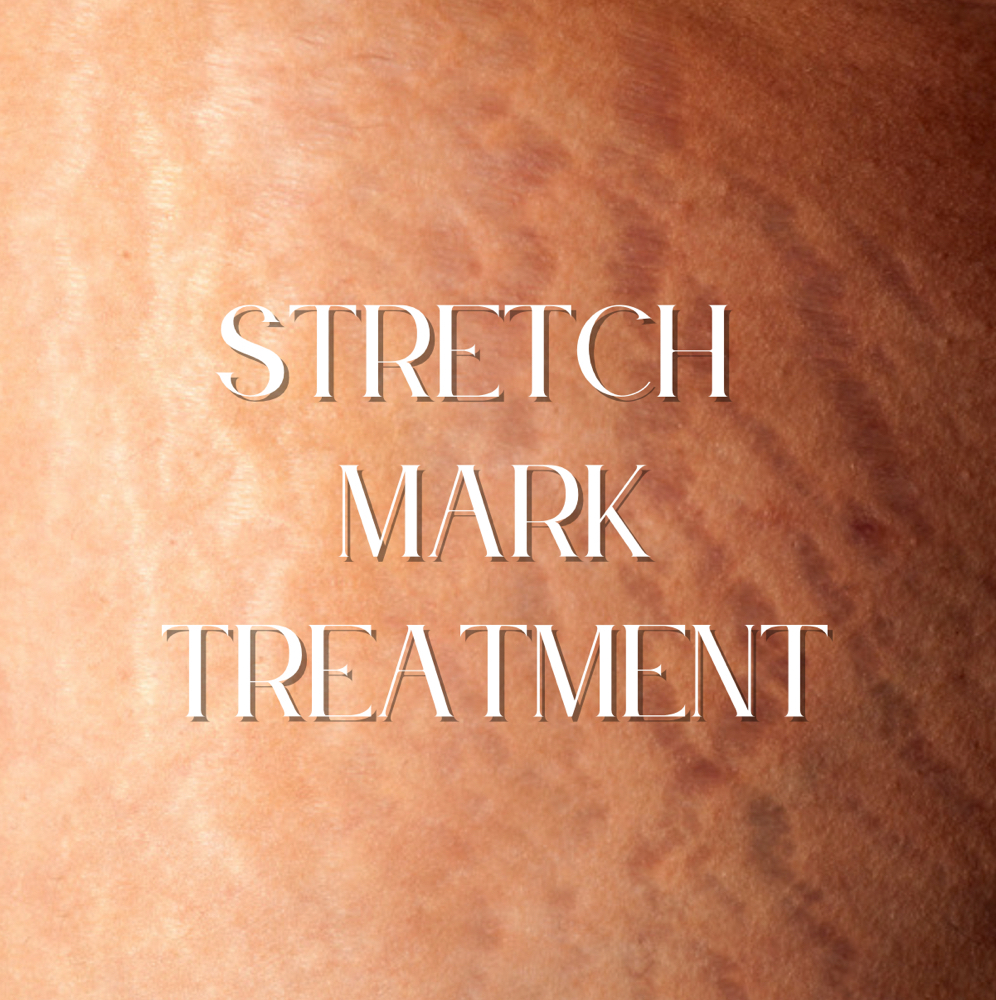 Stretch Mark Reduction