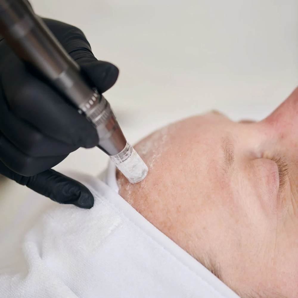 Poweful HA Facial