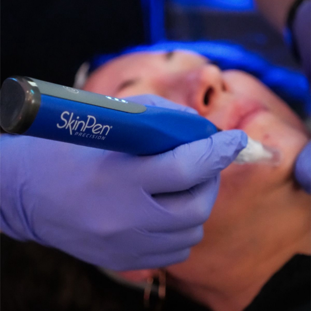 SkinPen® Microneedling at Beauty by Nurse C in Pembroke Pines, FL
