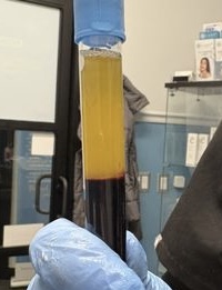liqPRF Regenerative Injection X 2