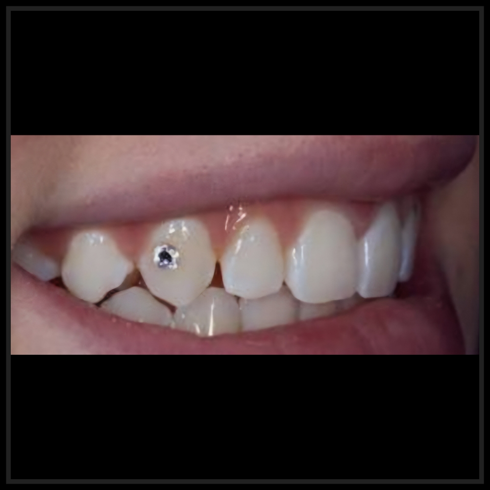 1 Teeth Gem